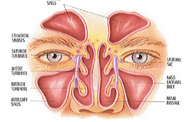 image of a diagram of the sinuses