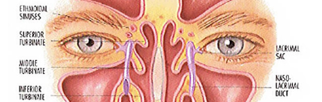 image of a diagram of the sinuses