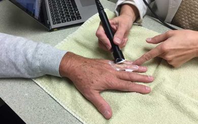 image of ultasound treatment on a finger