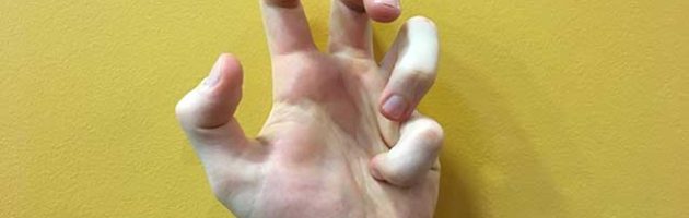 Image of hands in a pinkie fist hands yoga strengthening position