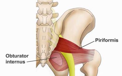 Image of illustration of the piriformus muscle